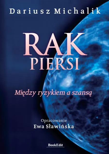 Rak piersi. Co warto wiedzieć? 